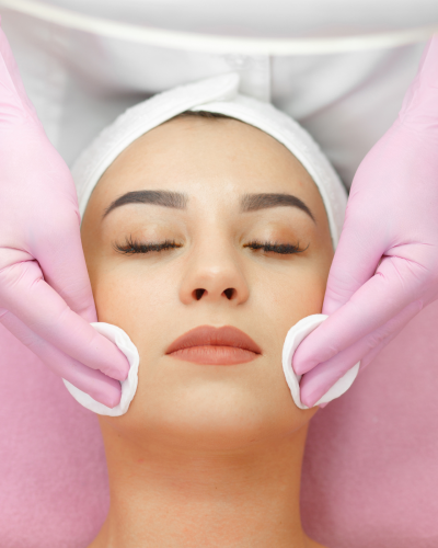 Perfect Face Therapy (Microneedling INCLUS)